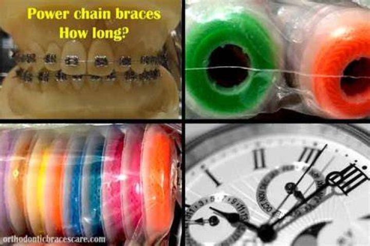 How long do power chains take to close gaps