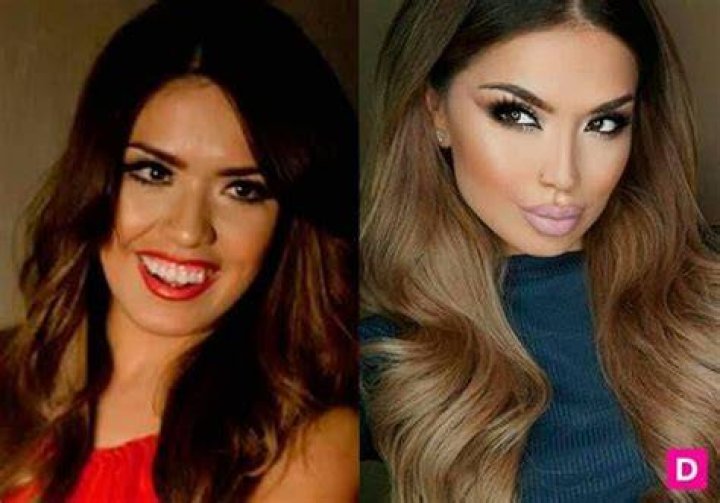 Iluvsarahii Before And After BBL Photos: Surgery Update 2023