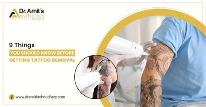 Skin Check-In With Dr. Will: 10 Things You Need to Know Before Getting a Tattoo Removed